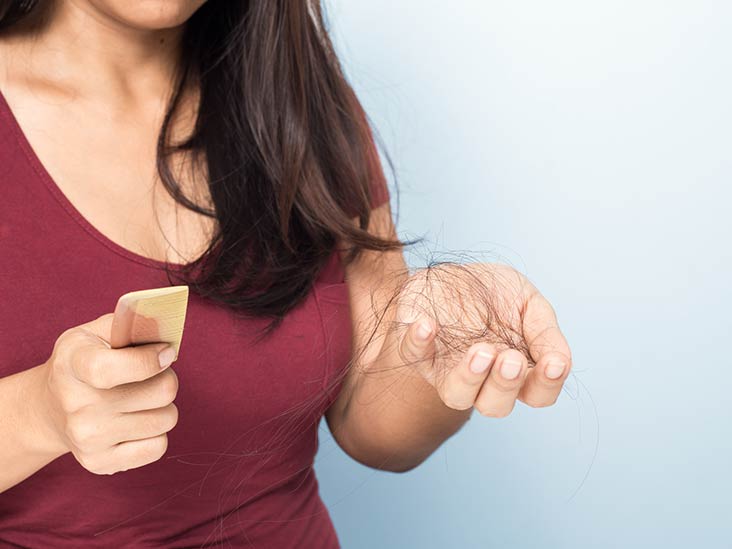 Top Five Causes Of Hair Loss